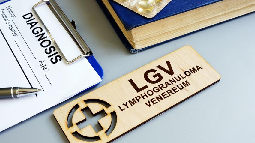 LGV, lymphogranuloma venereum, LGV tünetei, nemi betegség, nyirokcsomó, chlamydia, klamídia