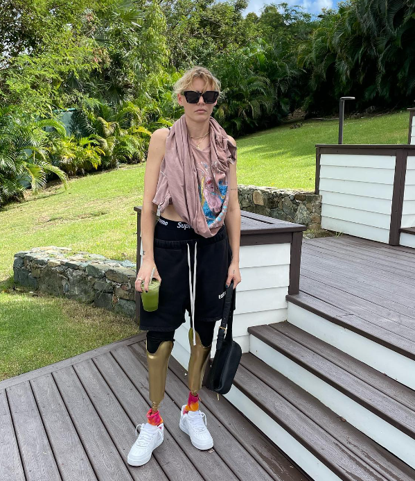 Krásna modelka prišla o obe nohy.