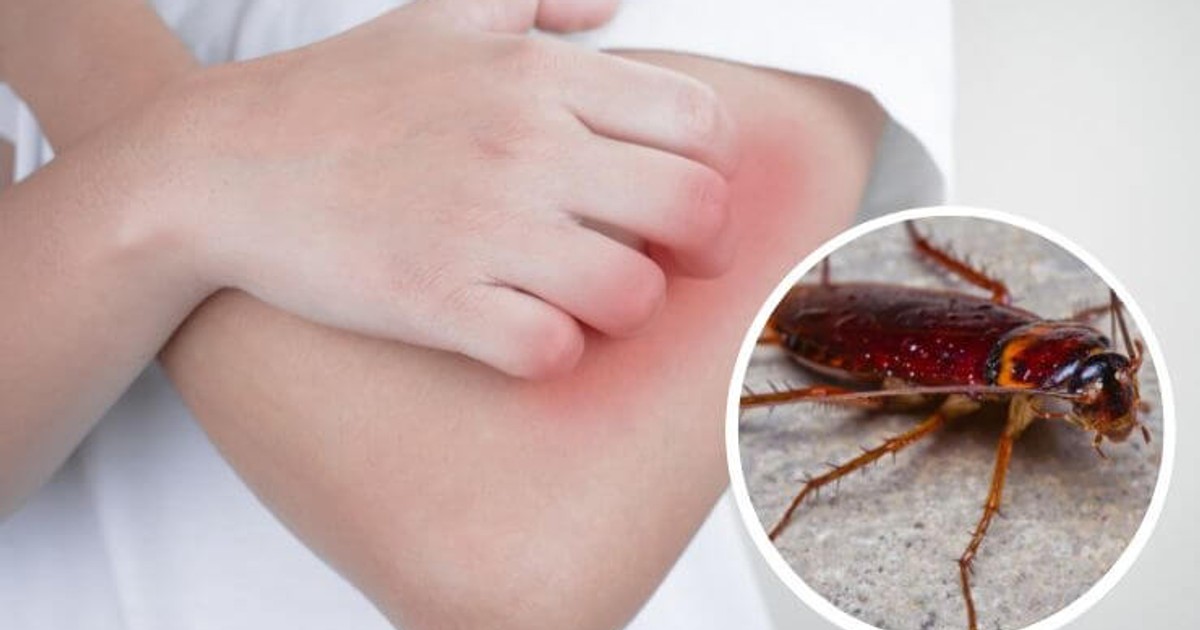 Do cockroaches bite and spread diseases? Pulse Nigeria