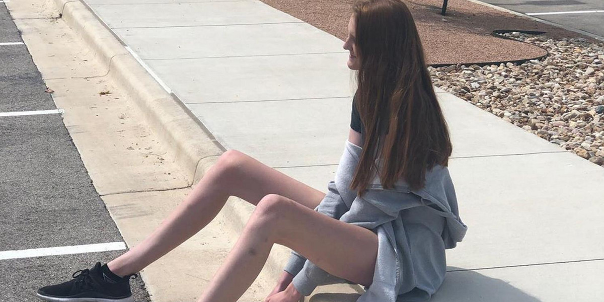 Ta dziewczyna ma najdłuższe nogi na świecie. I ciągle rośnie