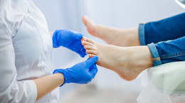 Problemy z cholesterolem widać na paznokciach u stóp. Subtelny sygnał łatwo przeoczyć