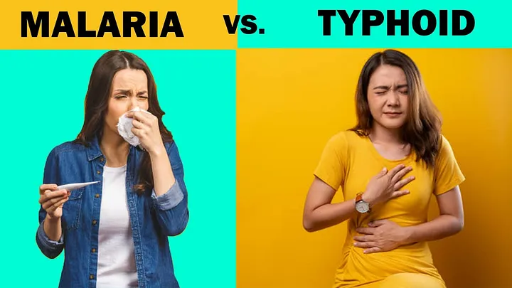 Difference between typhoid and malaria [medium]