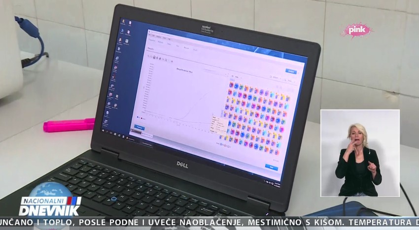 Primer pozitivnog uzorka