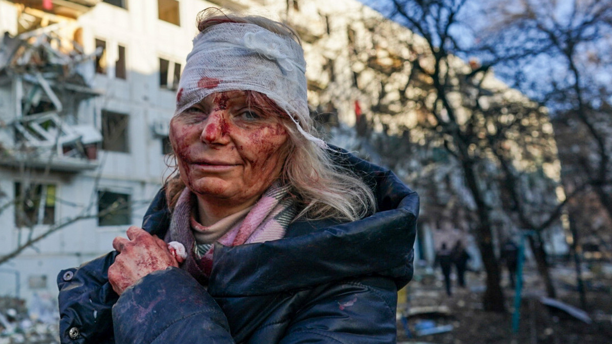 W prawym oku utknął kawałek szkła. Zdjęcie jej twarzy obiegło cały świat