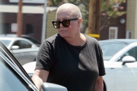 Bila je OLIČENJE LEPOTE, a onda se IZOBLIČILA i više ne liči na sebe: Nakon STRAŠNE BOLESTI je obrijala glavu i njene slike sve su ZAPREPASTILE