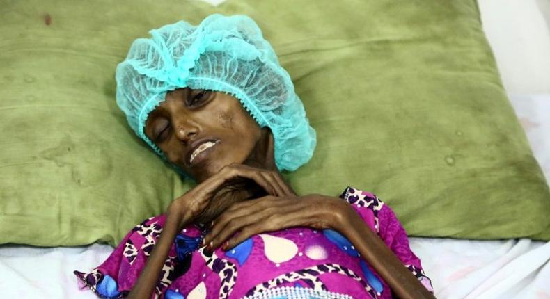 Saida Ahmad Baghili, an 18-year-old Yemeni woman lies in bed at the al-Thawra hospital in Hodeidah where she is receiving treatment for severe malnutrition on October 25, 2016