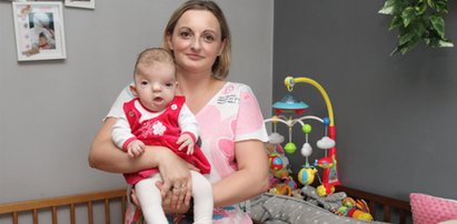 Maleńka Nadia wygląda, jakby miała dwa noski. Uratuje ją tylko nasza pomoc