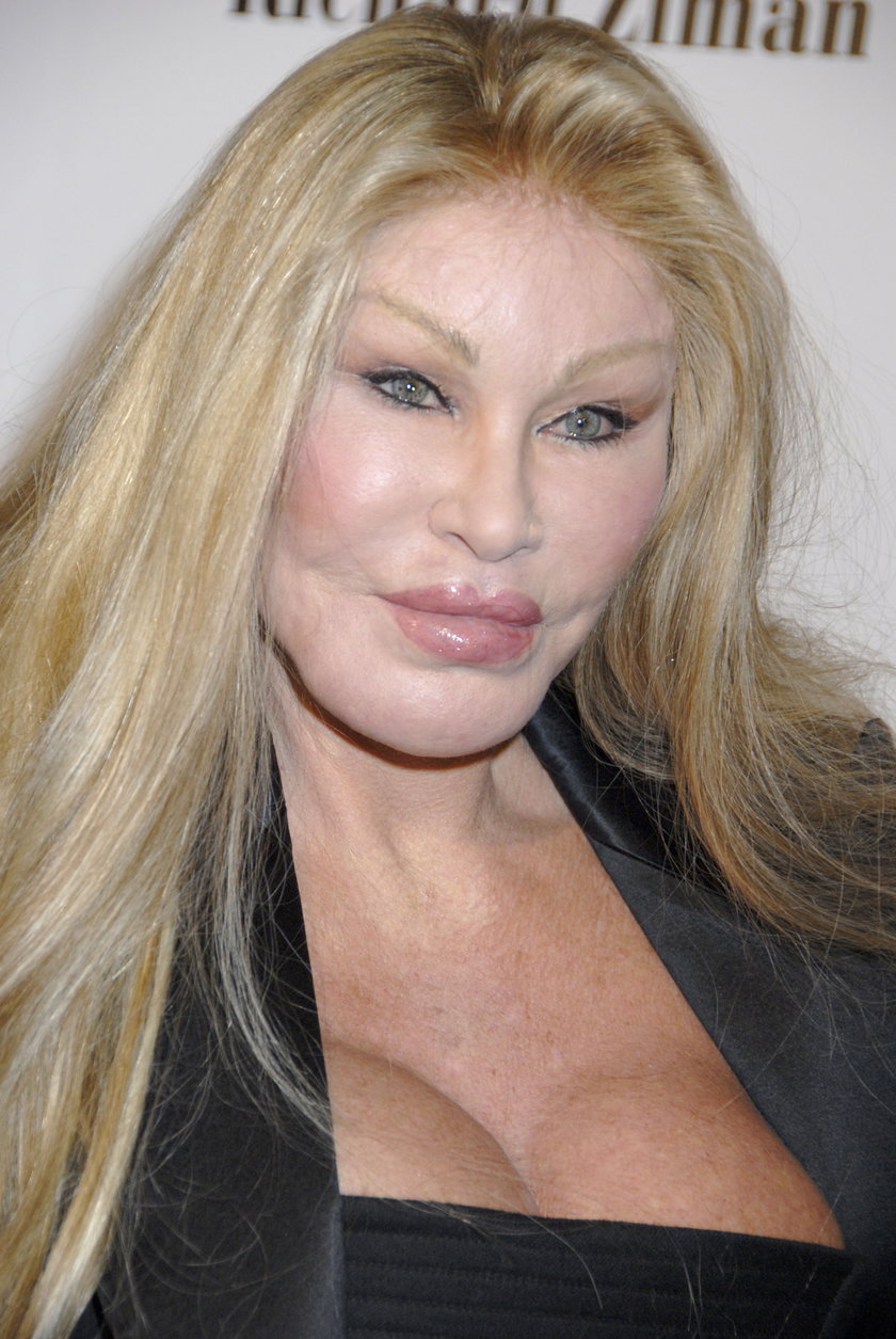 Jocelyn Wildenstein