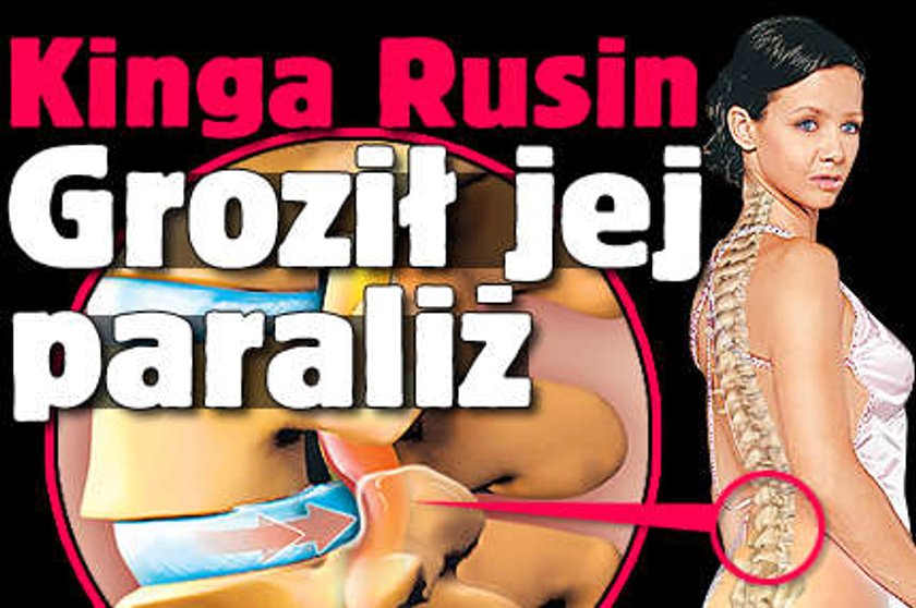 Kinga Rusin. Groził jej paraliż