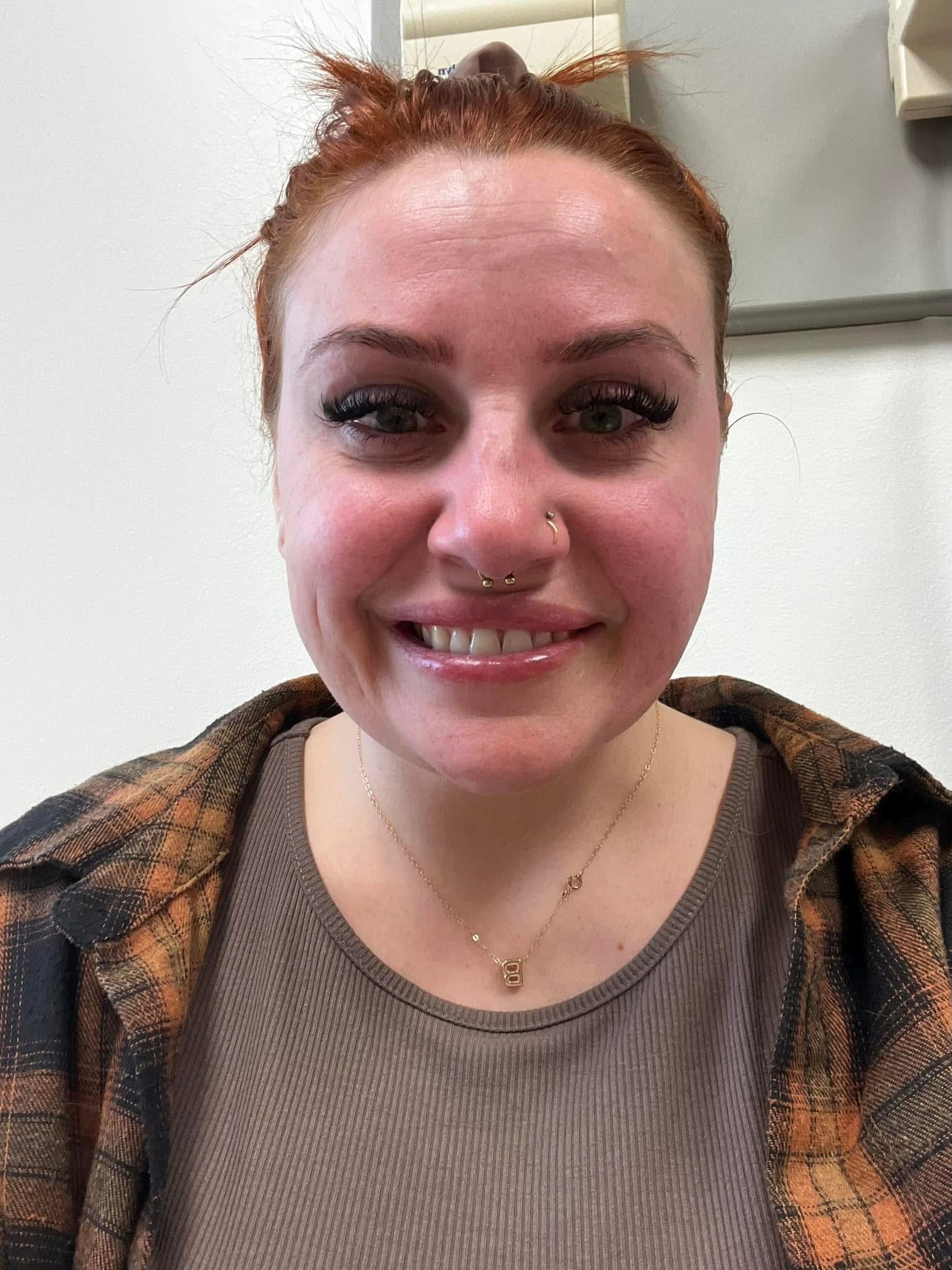 Kelly si všimla zvláštne príznaky len niekoľko dní pred svadbou.