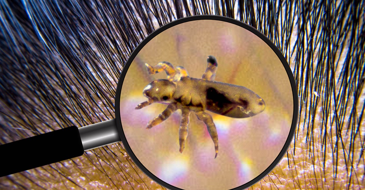 Czy Ocet Na Wszy To Dobry Pomysl