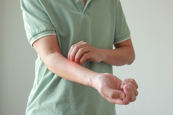Razlog svraba kože nije uvek na njenoj površini: Skriveni uzroci koje dermatolozi pronalaze tokom opservacije
