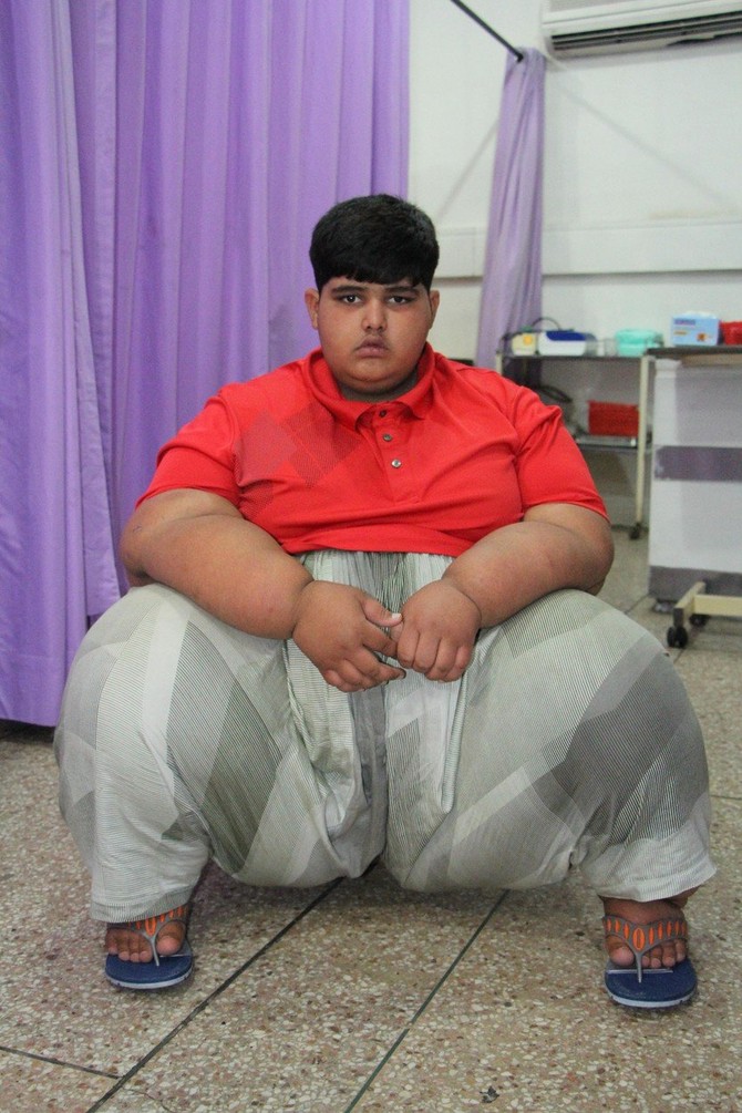 Muhamed je zvanično najdeblje dete na svetu