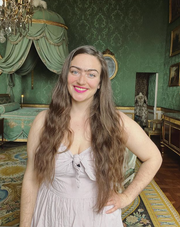 Eldina Jaganjac hrdo ukazuje chĺpky na tvári. 