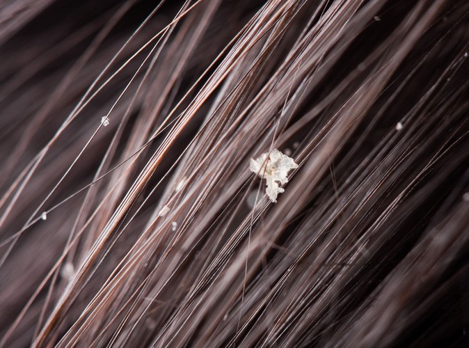 Ocet jabłkowy na łupież