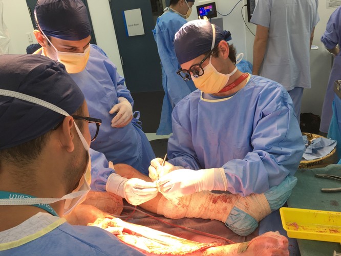 ODTWORZYLI KOŚĆ DZIĘKI DRUKARCE 3D