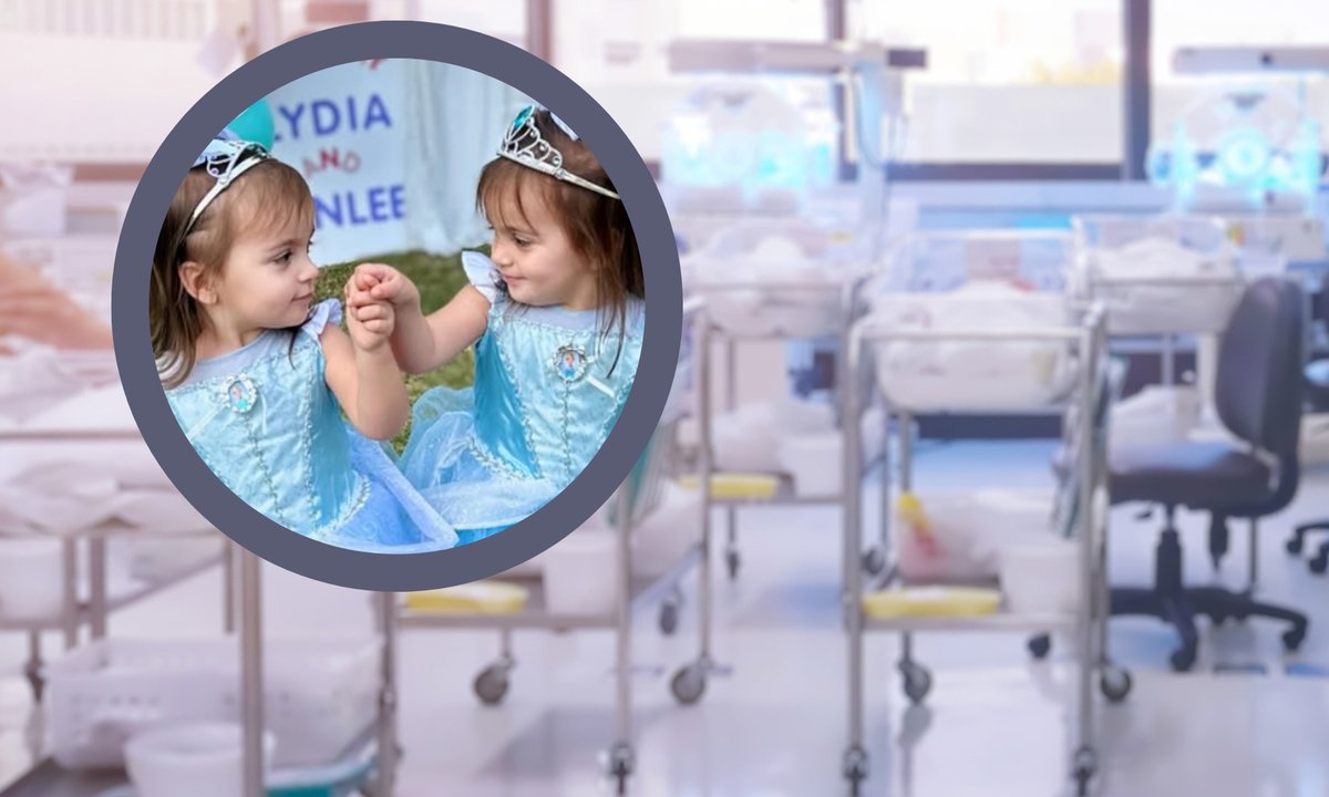 Niezwykłe bliźnięta. Takie dzieci przychodzą na świat raz na 35 tys. porodów