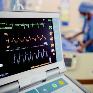 Az EKG típusai: mikor, melyik vizsgálatra van szükség?