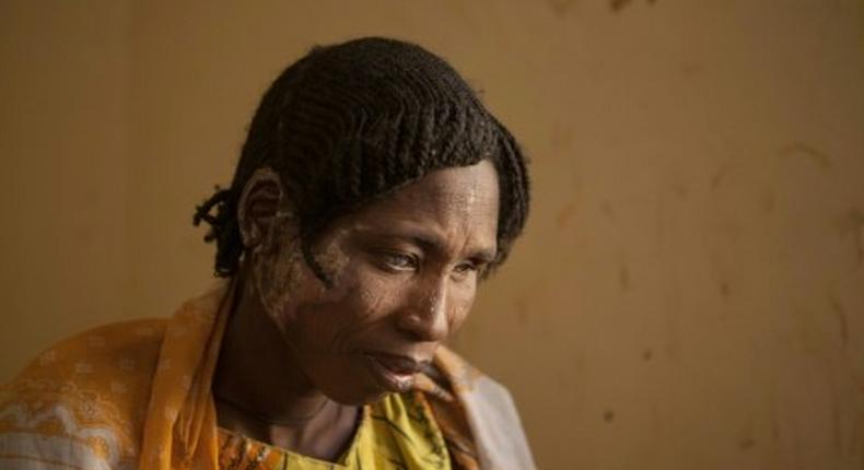 A woman receives medical care for burns following clashes between the Nigerian military and Boko Haram Islamists in Borno State