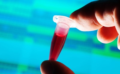 'Odmładzanie' krwi może spowalniać starzenie