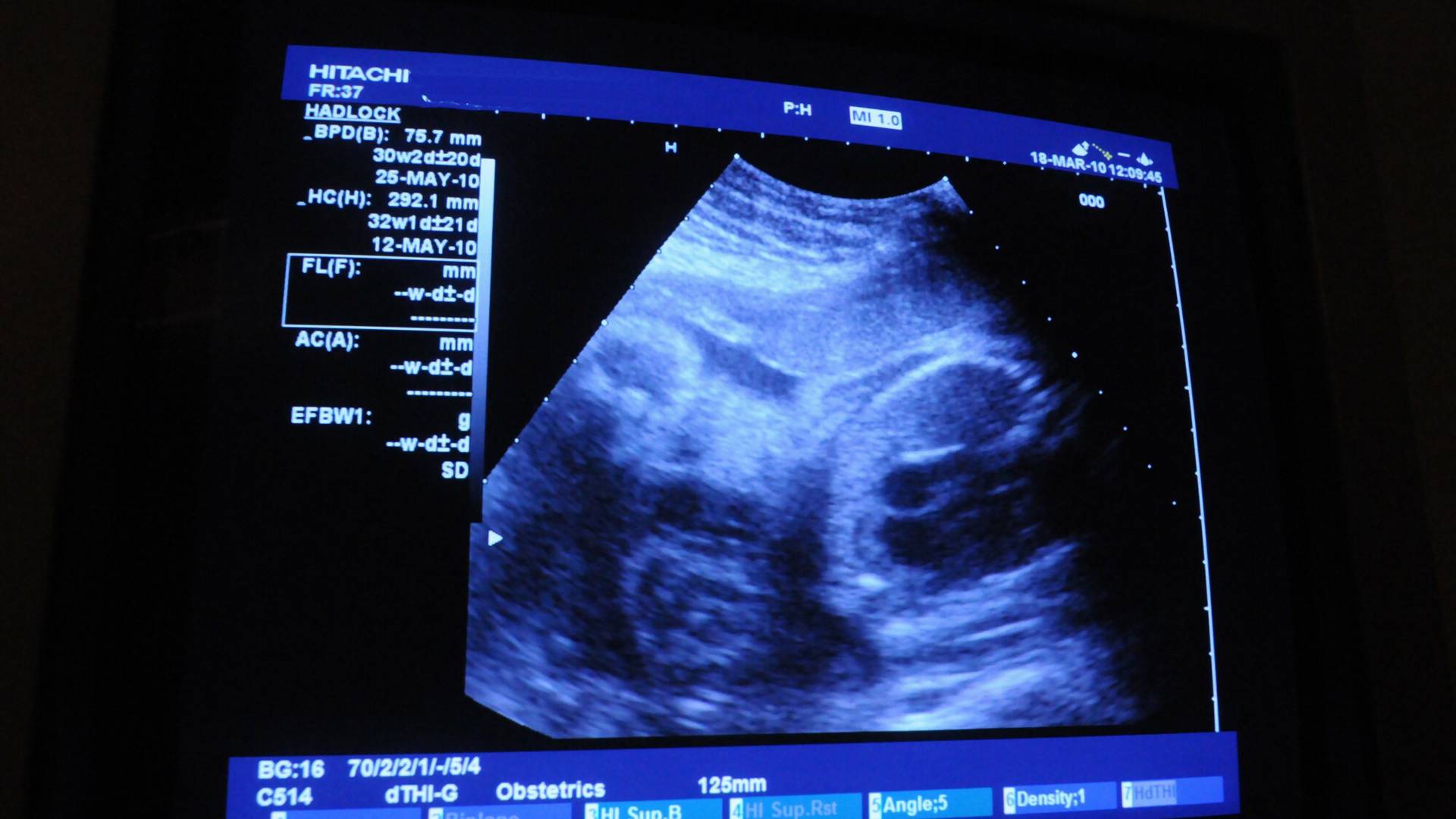 PiS planuje rejestr ciąż? Aktywistki uspokajają: "nie zakładamy najgorszego"
