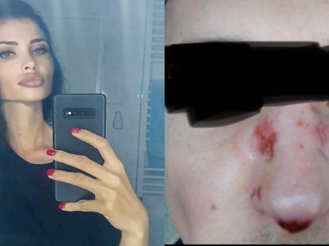 Olgica Markanović i njena žrtva
