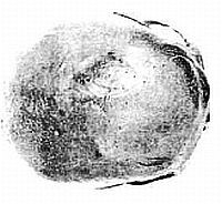 koponyalek-d000013EF19c0d32f5377