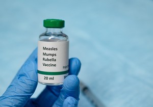 MMR, vakcine, male boginje