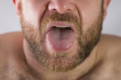 Fájó, égő nyelv - komoly hormonproblémát is jelezhet
