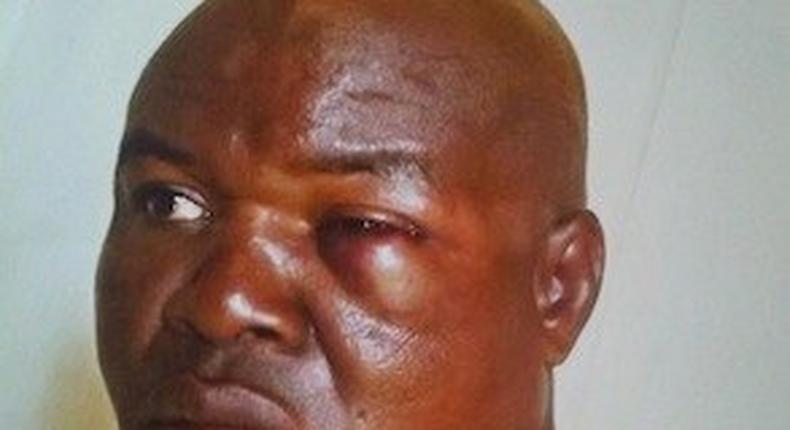 The okada rider, Chika Izuogu brutalized by Prophet for refusing to pay money for deliverance