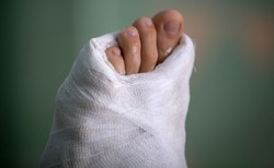 Stłuczenie, zwichnięcie, skręcenie, a może złamanie? Wszystko o kontuzjach