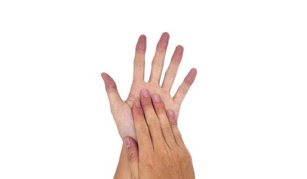 Ako telo proizvodi previše melanina, koža postaje tamnija, a ako telo ne proizvodi dovoljno melanina, koža postaje svetlija