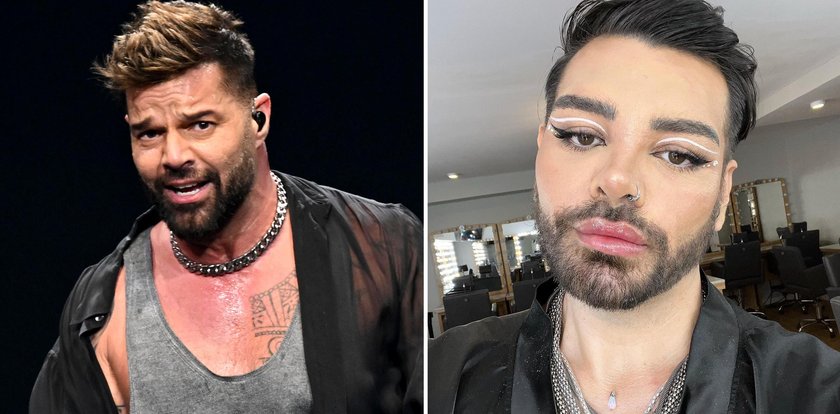 Chciał wyglądać jak Ricky Martin. Przeszedł 30 operacji plastycznych, ale coś nie wyszło...