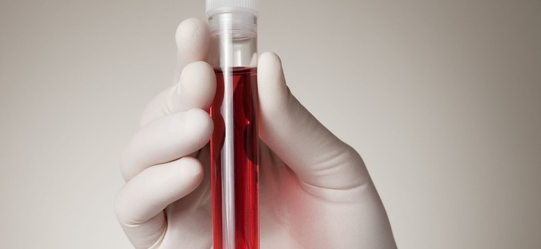 Zrób bezpłatny test na HIV. Co drugi zakażony HIV o tym nie wie