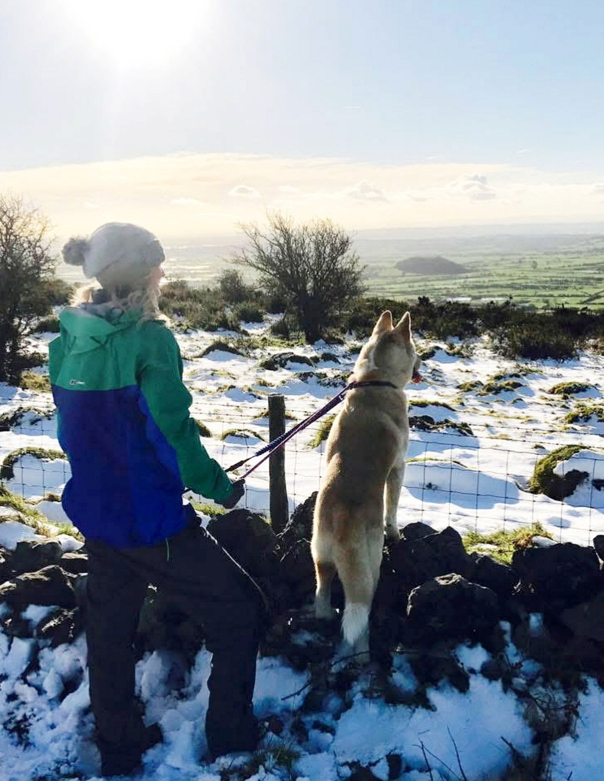 Z chrípky sa vykľula smrteľná meningitída, ktorá jej zmenila život od základov.