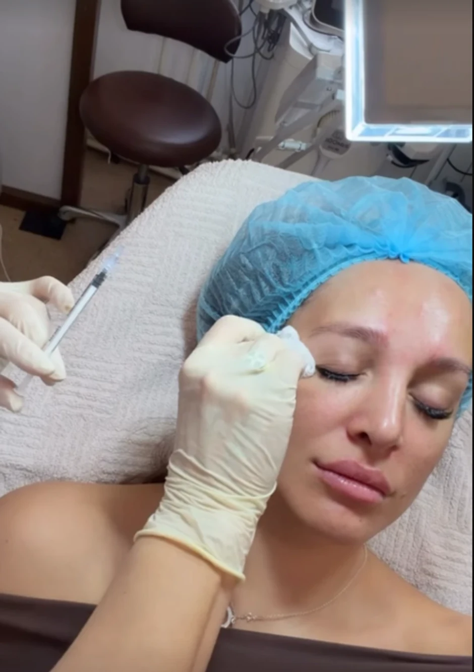 Luna Đogani ubrizgava botoks u lice