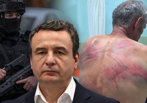 Kurti, prebijeni Nenad Rašković 