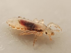 Nie tylko leki z apteki. 5 sposobów na pozbycie się wszy