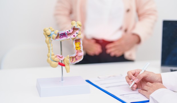 Bol kod raka debelog creva često ne počinje naglo niti dramatično