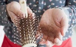 Dlaczego po porodzie kobieta traci włosy? Ekspert tłumaczy