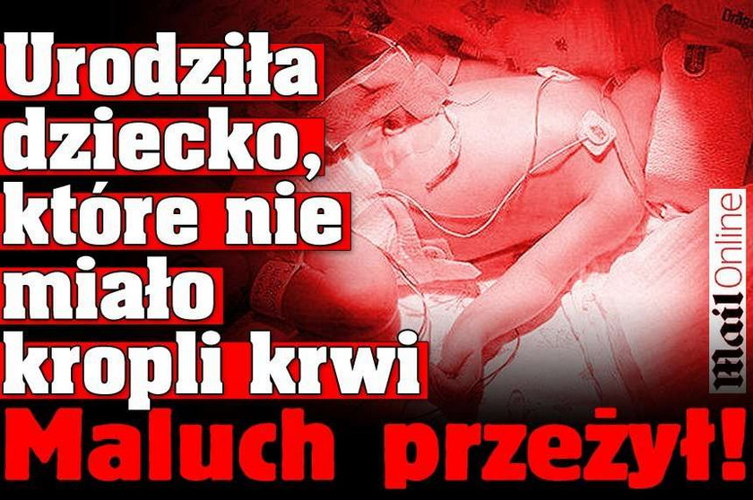 Urodziła dziecko, które nie miało kropli krwi. Maluch przeżył!