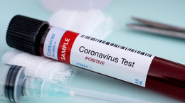 Południowoafrykański szczep koronawirusa SARS-CoV-2. Co o nim wiemy? [WYJAŚNIAMY]