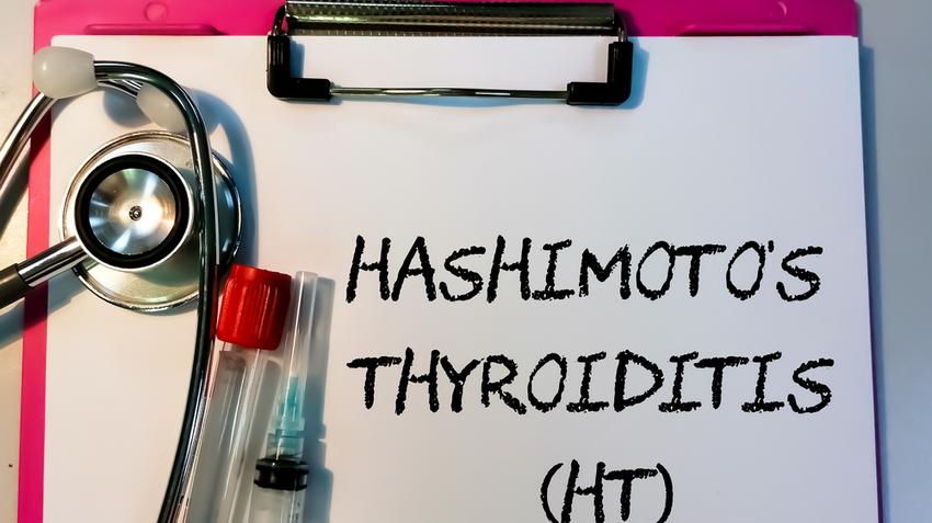 Hashimoto, Hashimoto-betegség, pajzsmirigy, thyreoiditis, autoimmun betegség, immunrendszer, jód, anyagcsere, hormontermelés, D-vitamin