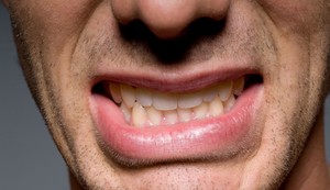 Osobe sa Parkinsonom imaju drugačiju bakterijsku floru u usnoj duplji
