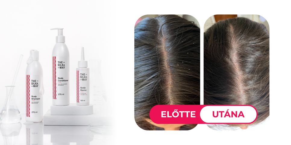 A The Silky Way Fejbőr Helyreállító termékcsaládjának hármasa segít, hogy fejbőröd újra egészséges legyen