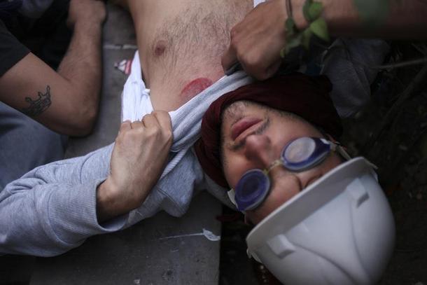 ankara turcja zamieszki protesty facet w okularach do pływania prezentuje rane wojenna?