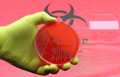 Új, izgalmas antibiotikumiot fedezett fel a mesterséges intelligencia
