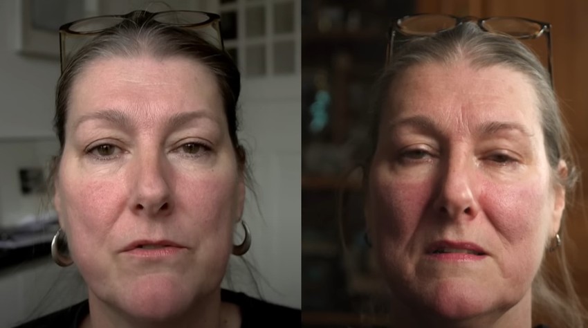 Razlika od 10 godina