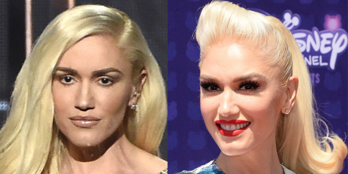 Co się dzieje z twarzą Gwen Stefani?