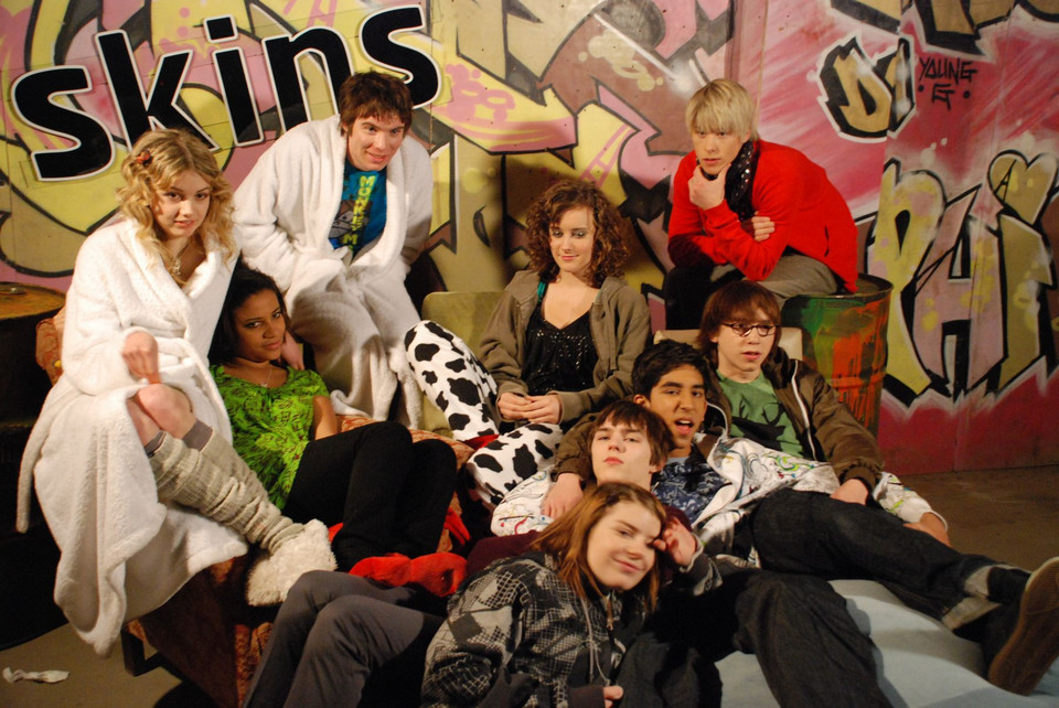 "Skins"